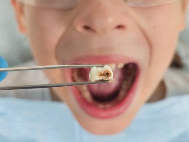Best Walk-In Emergency Dentist in Wellington, KS